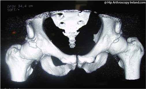 fai surgery